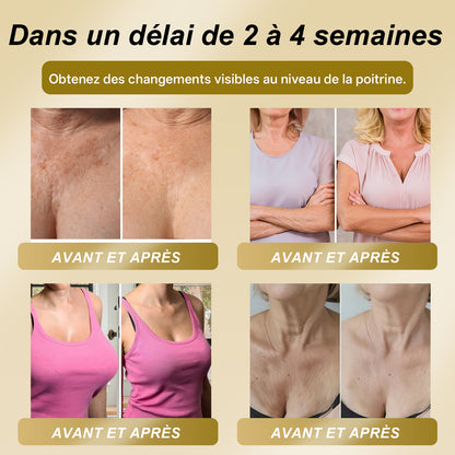 Magasin officiel phare |CleraLuxe® 🌞 Patch à la Gelée Royale Fermeté & Lift Sans danger pendant l'allaitement - Pour les problèmes tels que les seins peu développés, le relâchement, l'aplatissement, les plis cutanés et les mamelons foncés
